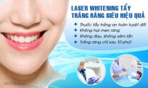 tẩy trắng răng có hại không,tẩy trắng răng có đau không,có nên tẩy trắng răng,tẩy trắng răng bằng laser whitening có hại không,tẩy trắng răng bằng laser có đau không
