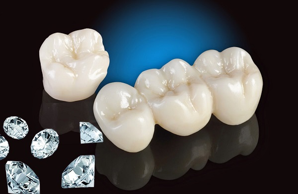 Răng sứ Dmax Kim cương