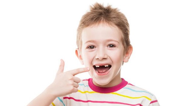 thay răng cửa bao lâu thì mọc,thay răng sữa, thay răng sữa sớm, thay răng sữa khi nào, thay răng sữa ở trẻ, thay răng sữa mọc lệch, thay răng sữa bao nhiêu cái, thay răng sữa muộn, thay răng sữa bao lâu thì mọc, thay răng sữa đầu tiên