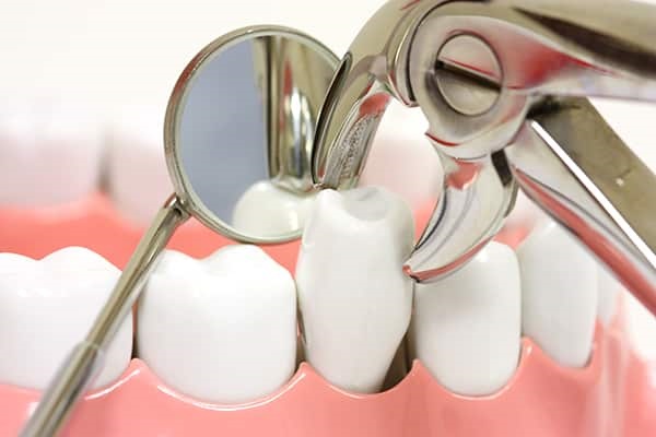 niềng răng nhổ răng số 4, răng số 4 là răng nào, nhổ răng số 4 có ảnh hưởng gì không, răng số 4 có mấy chân, nhổ răng số 4 có nguy hiểm không, nhổ răng số 4 hàm trên, niềng răng nhổ răng số 4 có nahr hưởng gì không,nhổ răng số 4 khi niềng răng, nhổ răng 4, rang so 4, nhổ răng số 4