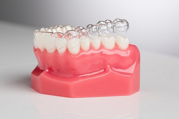 niềng răng trong suốt,niềng răng trong suốt giá bao nhiêu,niềng răng trong suốt giá,niềng răng trong suốt có hiệu quả không,niềng răng trong suốt có tốt không,niềng răng trong suốt có đau không,niềng răng trong suốt mất bao lâu,các loại niềng răng trong suốt,niềng răng trong suốt clear aligner,niềng răng trong suốt invisalign,niềng răng trong suốt là gì,niềng răng trong suốt giá bao nhiêu tiền,niềng răng trong suốt giá rẻ,nẹp răng trong suốt,niềng răng trong suốt bao lâu