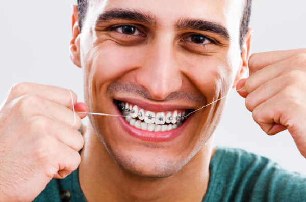 sau khi niềng răng nên làm gì,sau khi niềng răng xong,chuẩn bị gì trước khi niềng răng,các lưu ý khi niềng răng,lưu ý khi đeo niềng răng,những dấu hiệu khi mới niềng răng,sau khi niềng răng nên làm gì,những điều cần biết trước khi niềng răng,các vấn đề khi niềng răng,sau khi niềng răng xong,ngày đầu niềng răng