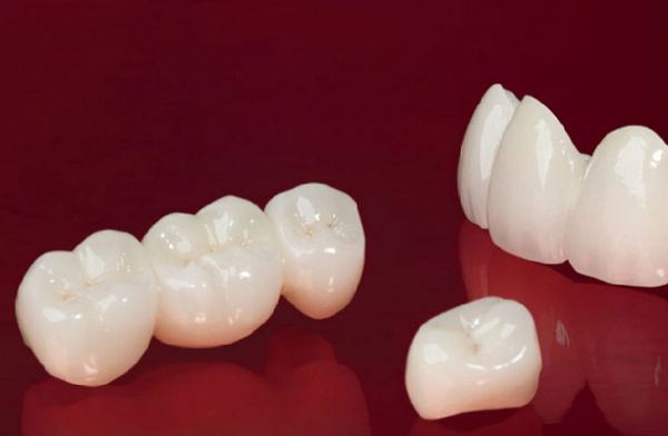 ưu nhược điểm của các loại răng sứ, ưu và nhược điểm của các loại răng sứ, ưu nhược điểm của bọc răng sứ, ưu nhược điểm của răng sứ