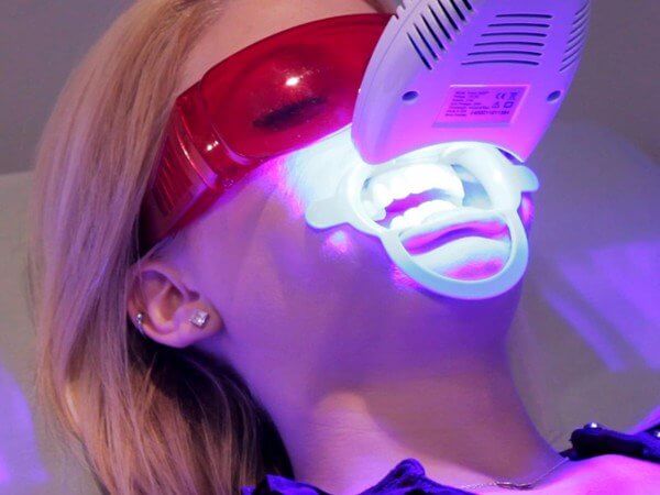 công nghệ tẩy trắng răng tốt nhất hiện nay, công nghệ tẩy trắng răng, công nghệ tẩy trắng răng mới nhất, công nghệ tẩy trắng răng hiện đại nhất, các công nghệ tẩy trắng răng