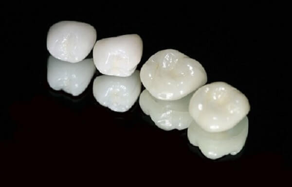răng sứ cercon và zirconia, so sánh răng sứ cercon và zirconia, so sánh răng sứ cercon và ceramill, so sánh các loại răng sứ, ưu điểm của bọc răng sứ, ưu nhược điểm của các loại răng sứ, các dòng răng sứ hiện nay, so sánh răng sứ cercon và venus, so sánh răng sứ venus và ceramill, so sánh các loại răng toàn sứ