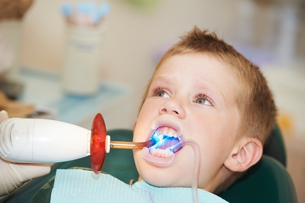 cách chữa sâu răng cho trẻ 2 tuổi, chữa sâu răng cho bé 2 tuổi, cách chữa sâu răng ở trẻ em