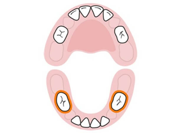bé mọc răng hàm,bé mọc răng hàm trước,bé mọc răng hàm số 7,bé mọc răng hàm lười ăn,bé mọc răng hàm sớm,bé mọc răng hàm trước răng cửa,bé mọc răng hàm sốt,bé mọc răng hàm bị ho,bé mọc răng hàm đau,bé mọc răng hàm bỏ ăn,bé mọc răng hàm trước răng nanh,bé mọc răng hàm đầu tiên,bé mọc răng hàm khóc đêm,bé mọc răng hàm dưới trước có sao không,bé mọc răng hàm trước có sao không,bé mọc răng hàm trên trước,bé mọc răng hàm trong bao lâu,bé mọc răng hàm bị đau,bé mọc răng hàm nên ăn gì,bé mọc răng hàm không chịu ăn,bé mọc răng hàm dưới trước,bé mọc răng hàm sốt cao,bé mọc răng hàm sưng lợi,bé mọc răng hàm sốt mấy ngày,bé mọc răng hàm trên trước có sao không,bé mọc răng hàm bị sốt,bé mọc răng hàm khi nào,bé mọc răng hàm có sốt không,bé mọc răng hàm nào trước,bé mọc răng hàm trên,bé mọc răng hàm sốt bao lâu,bé mọc răng hàm trong cùng,bé mọc răng hàm quấy khóc,bé mọc răng hàm có bị sốt không,bé mọc răng hàm có biểu hiện gì,em bé mọc răng hàm trên trước,em bé mọc răng hàm,em bé mọc răng hàm trước,khi bé mọc răng hàm,giảm đau khi bé mọc răng hàm,triệu chứng khi bé mọc răng hàm,biểu hiện khi bé mọc răng hàm,dấu hiệu khi bé mọc răng hàm,chăm sóc khi bé mọc răng hàm,làm gì khi bé mọc răng hàm,làm sao khi bé mọc răng hàm,khi nào bé mọc răng hàm,khi nào thì bé mọc răng hàm,bé mọc răng hàm biếng ăn,bé mọc răng hàm bị tiêu chảy,bé mọc răng hàm bị chảy máu,bé mọc răng hàm bị nôn,bé mọc răng hàm bị tím lợi,bé mọc răng hàm bị lệch,bé mọc răng hàm cuối,bé mọc răng hàm chảy máu,bé mọc răng hàm dưới,bé mọc răng hàm trên hay hàm dưới trước,dấu hiệu bé mọc răng hàm,bao giờ bé mọc răng hàm,giảm đau cho bé mọc răng hàm,cách giảm đau khi bé mọc răng hàm,biểu hiện bé mọc răng hàm,hình ảnh bé mọc răng hàm,hiện tượng bé mọc răng hàm,biểu hiện của bé mọc răng hàm,cách hạ sốt cho bé mọc răng hàm,bé mọc răng hàm khó ngủ,bé mọc răng hàm lúc nào,bé mọc răng hàm phải làm sao,bé mọc răng hàm sốt cao webtretho,bé mọc răng hàm bị sốt cao