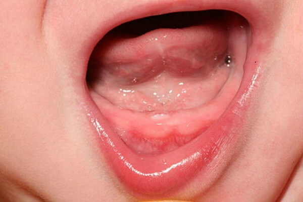 bé mọc răng hàm,bé mọc răng hàm trước,bé mọc răng hàm số 7,bé mọc răng hàm lười ăn,bé mọc răng hàm sớm,bé mọc răng hàm trước răng cửa,bé mọc răng hàm sốt,bé mọc răng hàm bị ho,bé mọc răng hàm đau,bé mọc răng hàm bỏ ăn,bé mọc răng hàm trước răng nanh,bé mọc răng hàm đầu tiên,bé mọc răng hàm khóc đêm,bé mọc răng hàm dưới trước có sao không,bé mọc răng hàm trước có sao không,bé mọc răng hàm trên trước,bé mọc răng hàm trong bao lâu,bé mọc răng hàm bị đau,bé mọc răng hàm nên ăn gì,bé mọc răng hàm không chịu ăn,bé mọc răng hàm dưới trước,bé mọc răng hàm sốt cao,bé mọc răng hàm sưng lợi,bé mọc răng hàm sốt mấy ngày,bé mọc răng hàm trên trước có sao không,bé mọc răng hàm bị sốt,bé mọc răng hàm khi nào,bé mọc răng hàm có sốt không,bé mọc răng hàm nào trước,bé mọc răng hàm trên,bé mọc răng hàm sốt bao lâu,bé mọc răng hàm trong cùng,bé mọc răng hàm quấy khóc,bé mọc răng hàm có bị sốt không,bé mọc răng hàm có biểu hiện gì,em bé mọc răng hàm trên trước,em bé mọc răng hàm,em bé mọc răng hàm trước,khi bé mọc răng hàm,giảm đau khi bé mọc răng hàm,triệu chứng khi bé mọc răng hàm,biểu hiện khi bé mọc răng hàm,dấu hiệu khi bé mọc răng hàm,chăm sóc khi bé mọc răng hàm,làm gì khi bé mọc răng hàm,làm sao khi bé mọc răng hàm,khi nào bé mọc răng hàm,khi nào thì bé mọc răng hàm,bé mọc răng hàm biếng ăn,bé mọc răng hàm bị tiêu chảy,bé mọc răng hàm bị chảy máu,bé mọc răng hàm bị nôn,bé mọc răng hàm bị tím lợi,bé mọc răng hàm bị lệch,bé mọc răng hàm cuối,bé mọc răng hàm chảy máu,bé mọc răng hàm dưới,bé mọc răng hàm trên hay hàm dưới trước,dấu hiệu bé mọc răng hàm,bao giờ bé mọc răng hàm,giảm đau cho bé mọc răng hàm,cách giảm đau khi bé mọc răng hàm,biểu hiện bé mọc răng hàm,hình ảnh bé mọc răng hàm,hiện tượng bé mọc răng hàm,biểu hiện của bé mọc răng hàm,cách hạ sốt cho bé mọc răng hàm,bé mọc răng hàm khó ngủ,bé mọc răng hàm lúc nào,bé mọc răng hàm phải làm sao,bé mọc răng hàm sốt cao webtretho,bé mọc răng hàm bị sốt cao