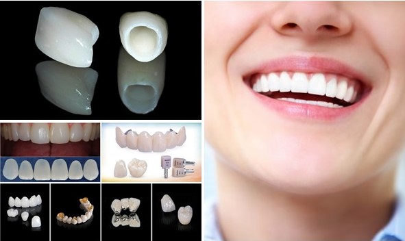 bọc răng sứ ở đâu tốt TPHCM, Nên bọc răng ở đâu tốt nhất tphcm, bọc răng sứ ở đâu tốt tphcm, răng sứ ở đâu HCM, bọc răng sứ ở đâu uy tín tại tphcm, Bọc răng sứ thẩm mỹ ở đâu tốt nhất tphcm, nên bọc răng sứ ở đâu tphcm, bọc răng sứ ở đâu tốt nhất tphcm