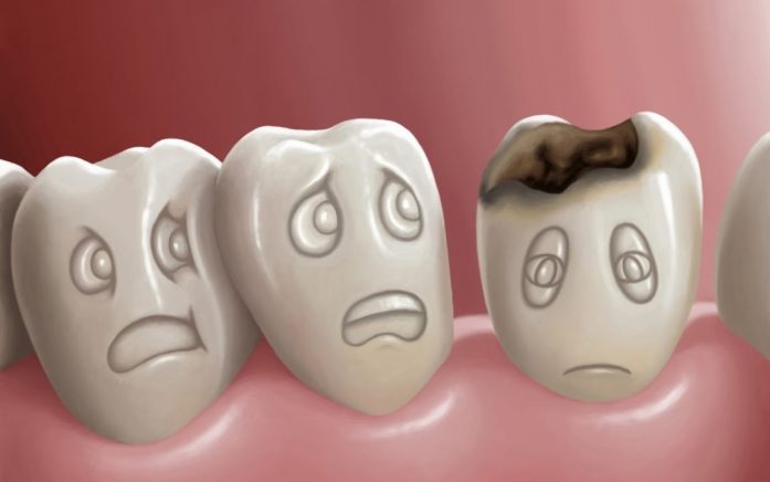 nhổ răng cấm bị sâu, nhổ răng cấm bị sâu bao nhiêu tiền, nhổ răng cấm bị sâu có nguy hiểm, giá nhổ răng cấm bị sâu, răng cấm, nhổ răng, nguy hiểm, giá nhổ răng cấm bị sâu là bao nhiêu