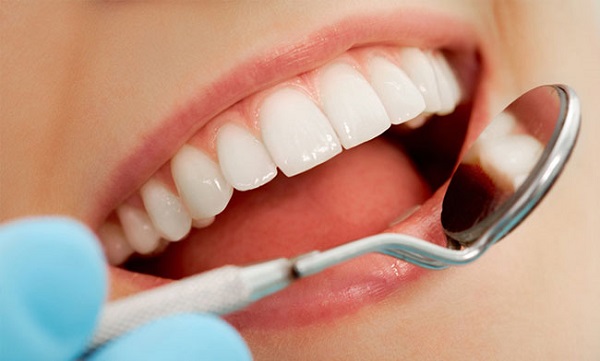 bọc răng sứ có tẩy trắng được không, răng bọc sứ có tẩy trắng được không, bọc răng sứ rồi có tẩy trắng được không