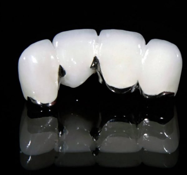 cách loại bỏ chấm đen trên răng, loại bỏ chấm đen trên răng, cách làm hết chấm đen trên răng, làm sao để loại bỏ chấm đen trên răng