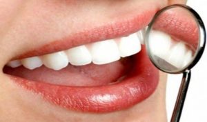 tẩy trắng răng có hại không webtretho, Có nên tẩy trắng răng không webtretho, tẩy trắng răng webtretho, tẩy trắng răng có đau không webtretho