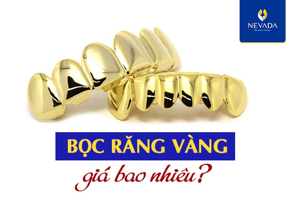 bọc răng vàng giá bao nhiêu tiền, bọc răng vàng giá bao nhiêu, bọc răng vàng hà nội, bọc răng vàng, bọc răng bằng vàng, cách bọc răng vàng, bọc răng mạ vàng, làm răng bọc vàng, bảng giá bọc răng vàng, răng bọc vàng, làm răng vàng, trồng răng vàng giá bao nhiêu, răng mạ vàng, răng bằng vàng, giá bọc răng vàng, làm răng vàng giá bao nhiêu, trồng răng vàng