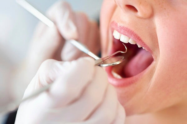 lấy cao răng định kỳ, lấy cao răng định kỳ có tốt không, có nên lấy cao răng định kỳ, tác dụng của lấy cao răng định kỳ