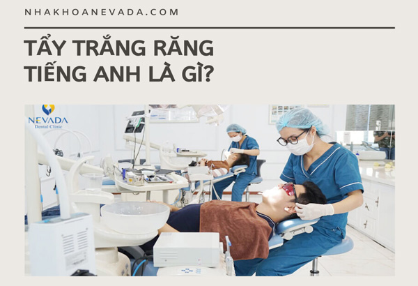 Tất tần tật về tẩy trắng răng tiếng anh là gì mà bạn cần biết