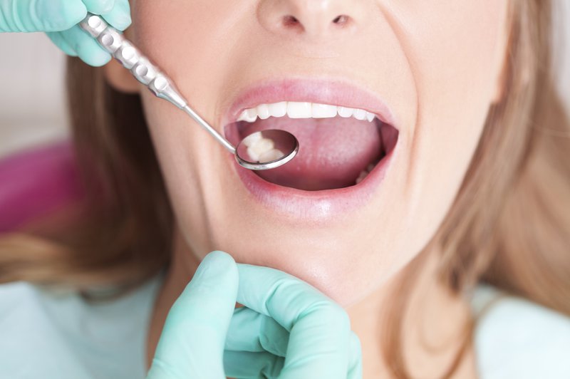 số răng của người trưởng thành, tổng số răng của người trưởng thành, số lượng răng của người trưởng thành, số răng đầy đủ của người trưởng thành, số răng hàm dưới của người trưởng thành