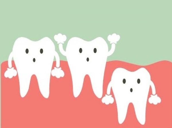 mọc răng khôn có đau không, mọc răng khôn có bị đau không, mọc răng khôn hàm trên có đau không, mọc răng khôn hàm dưới có đau không, mọc răng khôn có đau ko, mọc răng khôn có đau k