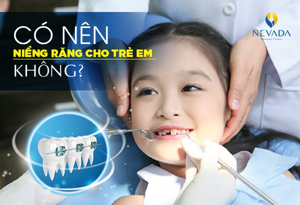 có nên niềng răng cho trẻ em không, có nên niềng răng cho trẻ, có nên niềng răng cho trẻ em, có nên niềng răng sớm cho trẻ