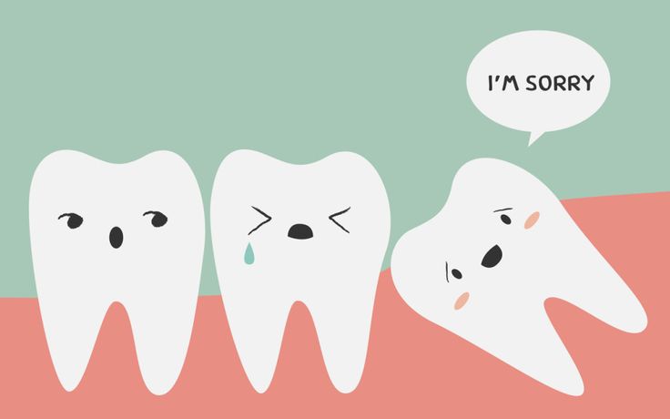 mọc răng khôn sớm, tại sao lại mọc răng khôn sớm, răng khôn mọc sớm, mọc răng khôn sớm có tốt không, mọc răng khôn sớm thì sao, mọc răng khôn sớm có sao không
