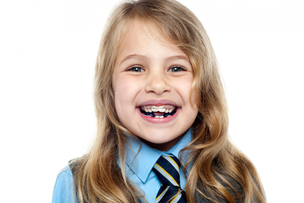 niềng răng cho trẻ em có đau không, niềng răng cho trẻ có đau không, niềng răng cho trẻ có đau không webtretho