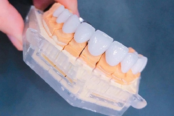 bọc răng sứ giá bao nhiêu tphcm, giá bọc răng sứ tphcm, giá bọc răng sứ bệnh viện răng hàm mặt tphcm