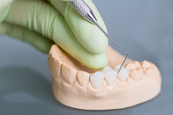 bọc răng sứ nguyên hàm, bọc sứ cả hàm, bọc sứ nguyên hàm, có nên bọc răng sứ cả hàm, có nên bọc răng sứ nguyên hàm không