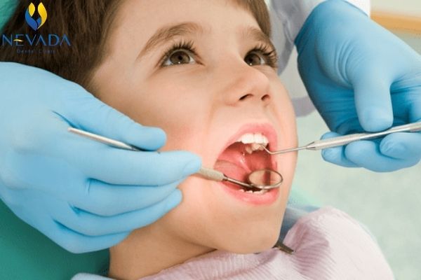 răng hàm của trẻ nhỏ có thay không, răng hàm trẻ nhỏ có thay không, ăng hàm sữa có thay ko, răng hàm có thay như răng sữa không, răng hàm của bé có thay không, răng hàm của bé có thay k, răng cối sữa có thay không
