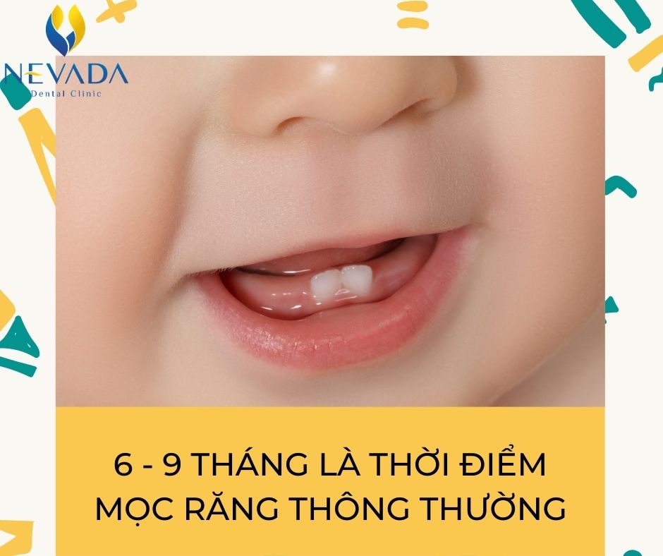 trẻ chậm mọc răng phải làm sao, trẻ chậm mọc răng, chậm mọc răng vĩnh viễn, trẻ chậm mọc răng vĩnh viễn, răng cửa vĩnh viễn mọc chậm, Bé chậm mọc răng nên ăn gì, Cách khắc phục trẻ chậm mọc răng, trẻ chậm mọc răng nên uống thuốc gì, trẻ chậm mọc răng cần bổ sung gì, trẻ chậm mọc răng khám ở đâu, trẻ chậm mọc răng có ảnh hưởng gì không, trẻ chậm mọc răng có nên bổ sung canxi