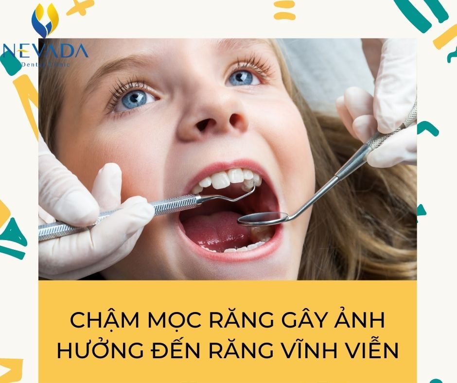 trẻ chậm mọc răng phải làm sao, trẻ chậm mọc răng, chậm mọc răng vĩnh viễn, trẻ chậm mọc răng vĩnh viễn, răng cửa vĩnh viễn mọc chậm, Bé chậm mọc răng nên ăn gì, Cách khắc phục trẻ chậm mọc răng, trẻ chậm mọc răng nên uống thuốc gì, trẻ chậm mọc răng cần bổ sung gì, trẻ chậm mọc răng khám ở đâu, trẻ chậm mọc răng có ảnh hưởng gì không, trẻ chậm mọc răng có nên bổ sung canxi