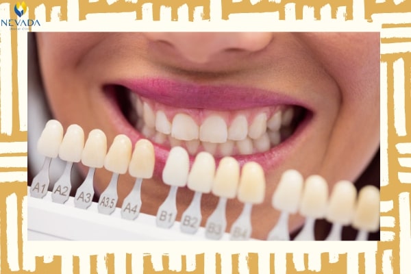 thiểu sản men răng là gì, thiểu sản men răng, thiểu sản răng là gì, thiểu sản ngà răng, thiểu sản răng ở trẻ, thiểu sản ngà răng, răng sữa bị thiểu sản, thiểu sản men răng