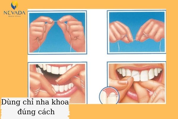 Bị bệnh sâu răng kiêng ăn gì (4)