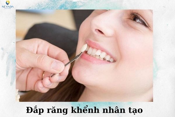 Răng khểnh và răng nanh khác nhau như thế nào (4)