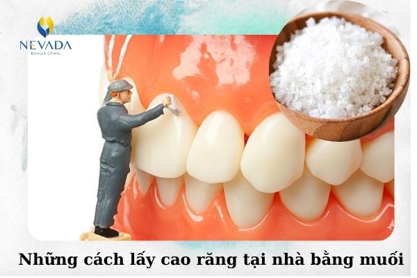 cách lấy cao răng tại nhà bằng muối