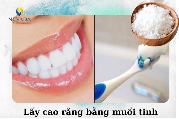 cách lấy cao răng tại nhà bằng muối (2)