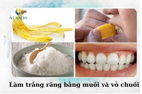 cách lấy cao răng tại nhà bằng muối (4)