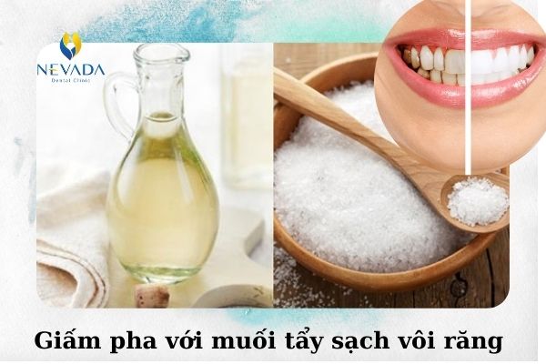 cách lấy cao răng tại nhà bằng muối (6)