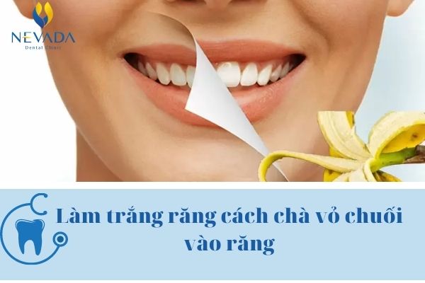 răng vàng bẩm sinh có tẩy trắng được không (3)