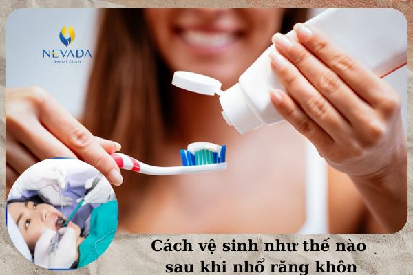 vệ sinh sau khi nhổ răng khôn, cách vệ sinh sau khi nhổ răng số 8, cách vệ sinh sau khi nhổ răng hàm, vệ sinh răng miệng sau khi nhổ răng số 8, cách giữ vệ sinh sau khi nhổ răng khôn, vệ sinh như thế nào sau khi nhổ răng khôn, vệ sinh hốc răng sau khi nhổ, cách vệ sinh răng miệng sau khi nhổ răng số 8, vệ sinh răng miệng đúng cách sau khi nhổ răng, Cách vệ sinh răng miệng sau khi nhổ răng khôn