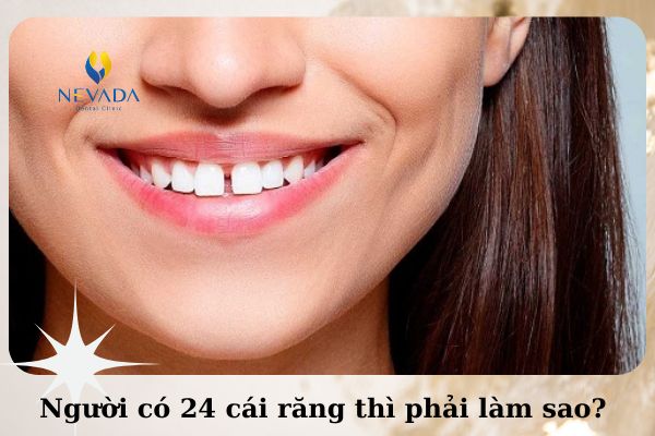 người có 24 cái răng, người có 24 cái răng phải làm saongười có 24 cái răng thì sao, người có 24 cái răng thì như thế nào