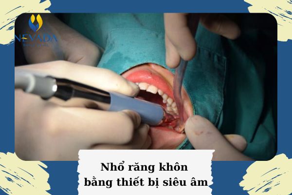 nhổ răng khôn hàm dưới có nguy hiểm không, nhổ răng khôn hàm dưới có nguy hiểm, nhổ răng khôn hàm trên hay dưới nguy hiểm hơn