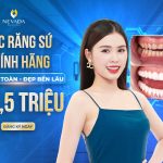 [OFF 50% Bọc răng sứ Invy Ultra 3P] Đẹp an toàn – Đẹp bền lâu